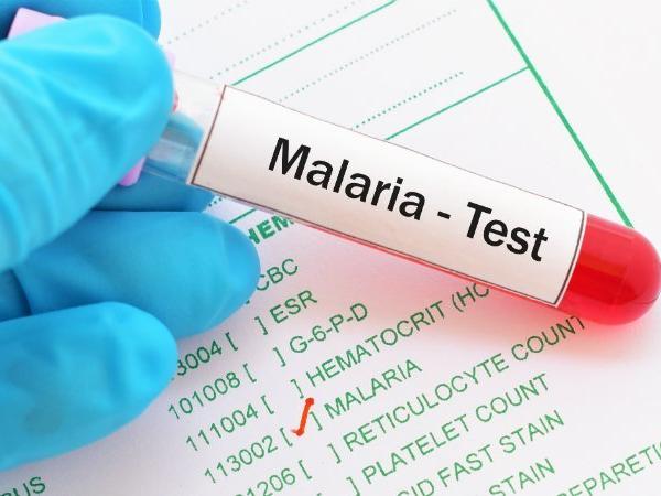 large pilot trial for malaria vaccine in malawi